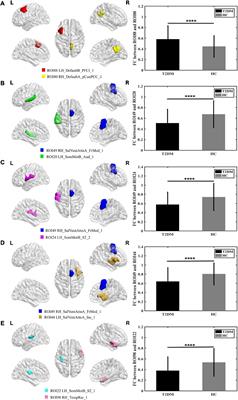 Aberrant brain functional networks in type 2 diabetes mellitus: A graph theoretical and support-vector machine approach